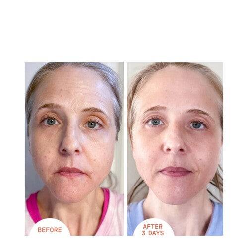 Visible skin tone and texture improvement after 3 days of using Dr Dennis Gross Alpha Beta Peel Extra Strength Formula, ideal for mature skin.