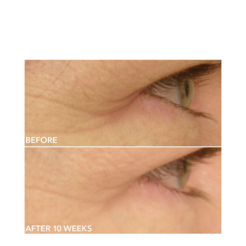 Δρ Dennis Gross DRX Φασματοναλίτης Eyecare Max Pro
