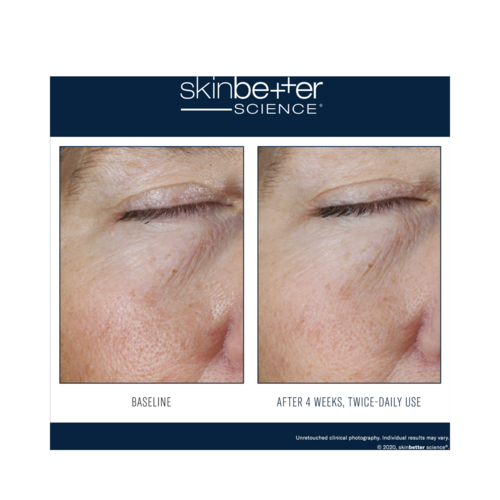 SkinBetter מדע אפקט מיידי עין ג'ל