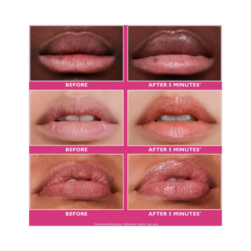 Peter Thomas Roth Firmx Instant Lip Filler を使用する前と使用した後の唇の比較。臨床的に証明された結果が数分で得られます。