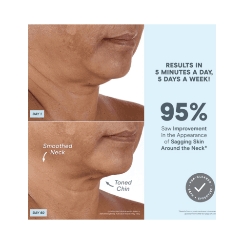 تحسن ملحوظ في لون الرقبة والذقن باستخدام جهاز NuFace MINI+ Petite Facial Toning Device خلال 60 يومًا. نتائج مثبتة سريريًا مع الاستخدام المستمر.