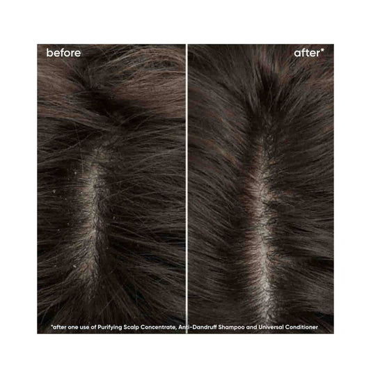 Πριν και μετά τα αποτελέσματα του Biolage Scalp Sync Conditioner που δείχνουν βελτιωμένη διαύγεια του τριχωτού της κεφαλής και μειωμένη πιτυρίδα μετά τη χρήση.