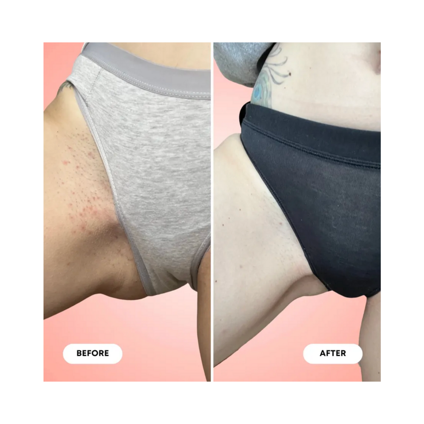 Bushbalm Summer Vacay Exfoliating Scrub Ingrown Hair