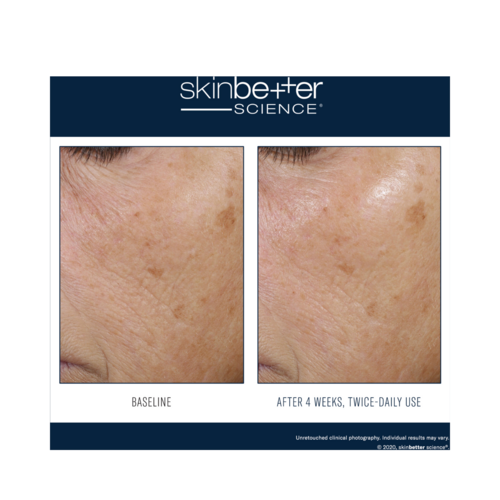 Skinbetter Moisturizer Trio Rebalancing の臨床結果では、継続的な使用後に乾燥が軽減され、肌の質感が改善されたことが示されています。