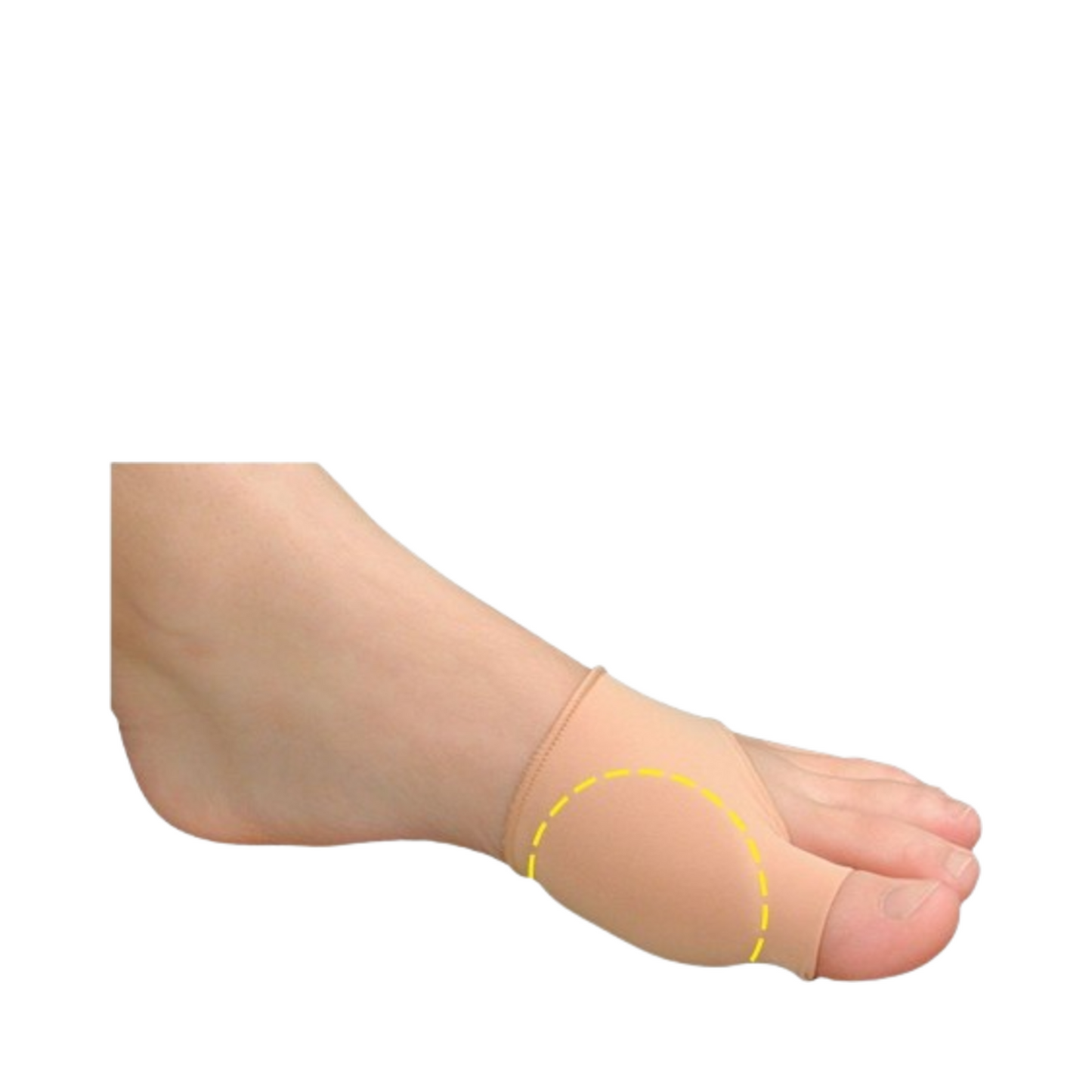 Pedifix Visco-GEL Bunion Relief Sleeve on foot, highlighting ergonomic design and gel support for bunion protection and pressure relief.