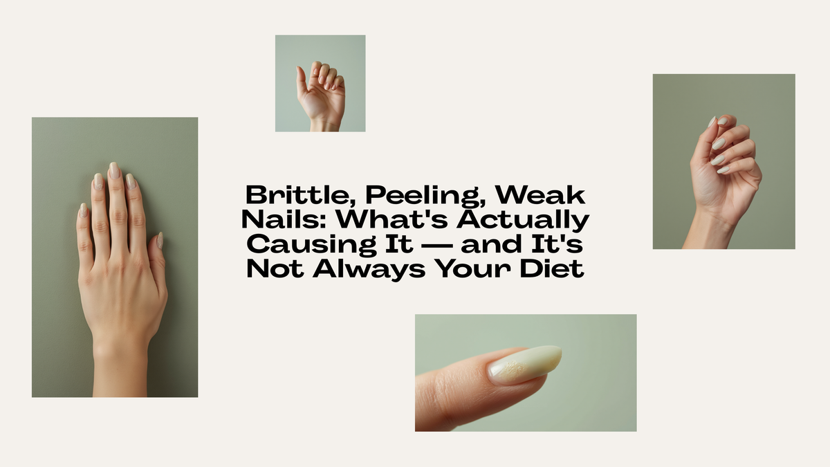 Brittle, peeling, weak nails: What's actually causing it and it's not always your diet