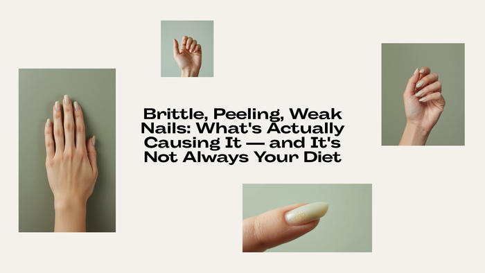 Brittle, peeling, weak nails: What's actually causing it and it's not always your diet