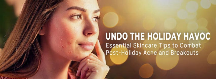 Woman with acne touching her face – post-holiday skincare tips.