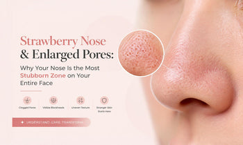 Strawberry Nose