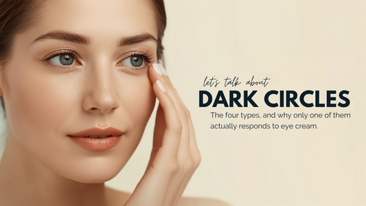 Dark circles: The four types, and why only one of them actually responds to eye cream