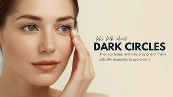 Dark circles: The four types, and why only one of them actually responds to eye cream