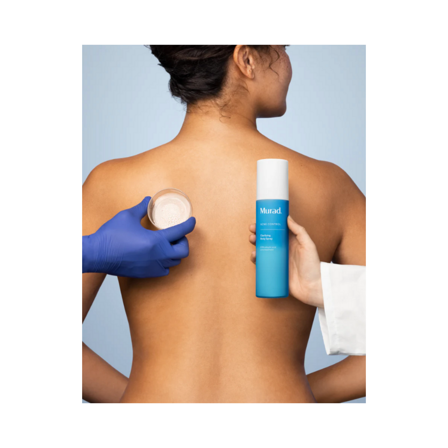 Murad Clarifying Body Spray applied to woman's back by dermatologist, demonstrating acne treatment for hard-to-reach areas.