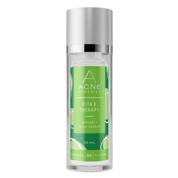 Rhonda Allison Acne Remedies Vita E Therapy