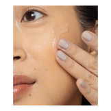 Système de traitement de l'acné de Vivierskin