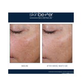 Before and after comparison of skin using AlphaRet Overnight Cream for 8 weeks, showing visible reduction in fine lines and texture.