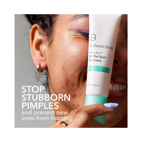 Close-up of woman smiling with Dr Dennis Gross Spot Eliminator, highlighting its power to stop pimples and prevent future breakouts.