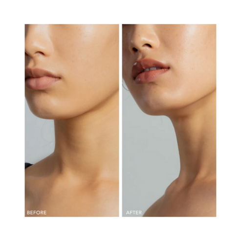 Foreo mikrovirta kasvojen sävytyslaite 1 kappale