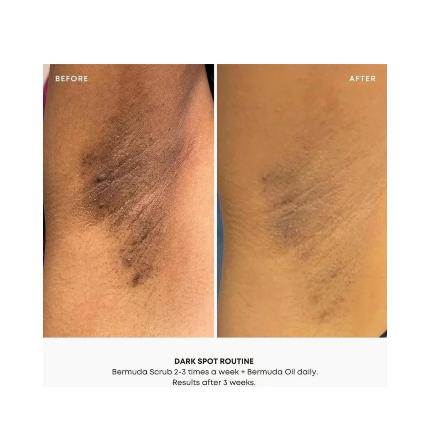 Bushbalm Bermuda Oil Dark Spot