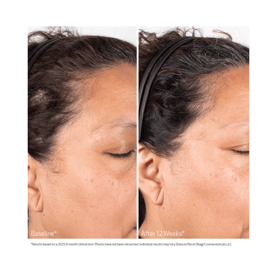 Obagi Biostim hársvörð Serum