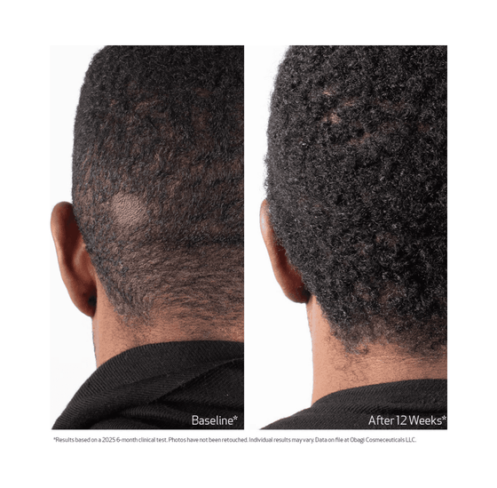 Obagi Biostim hársvörð Serum