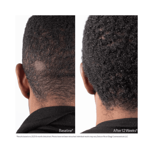 Obagi Biostim Scalp Serum