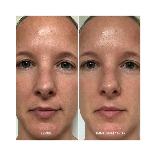 تشرق الهيدروبتيد البولندية ووجه قشرة الوجه ممتلئ