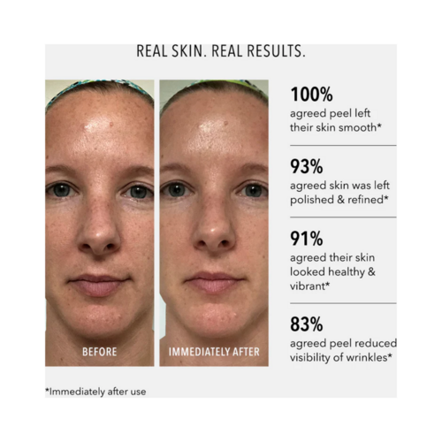 تشرق الهيدروبتيد البولندية ووجه قشرة الوجه ممتلئ