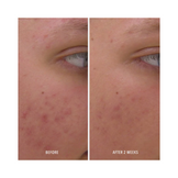 Sero de rescate claro de hidropéptido