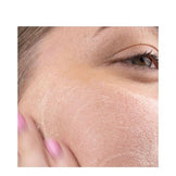 O Cosmedics Corrective Cleanser and Peel