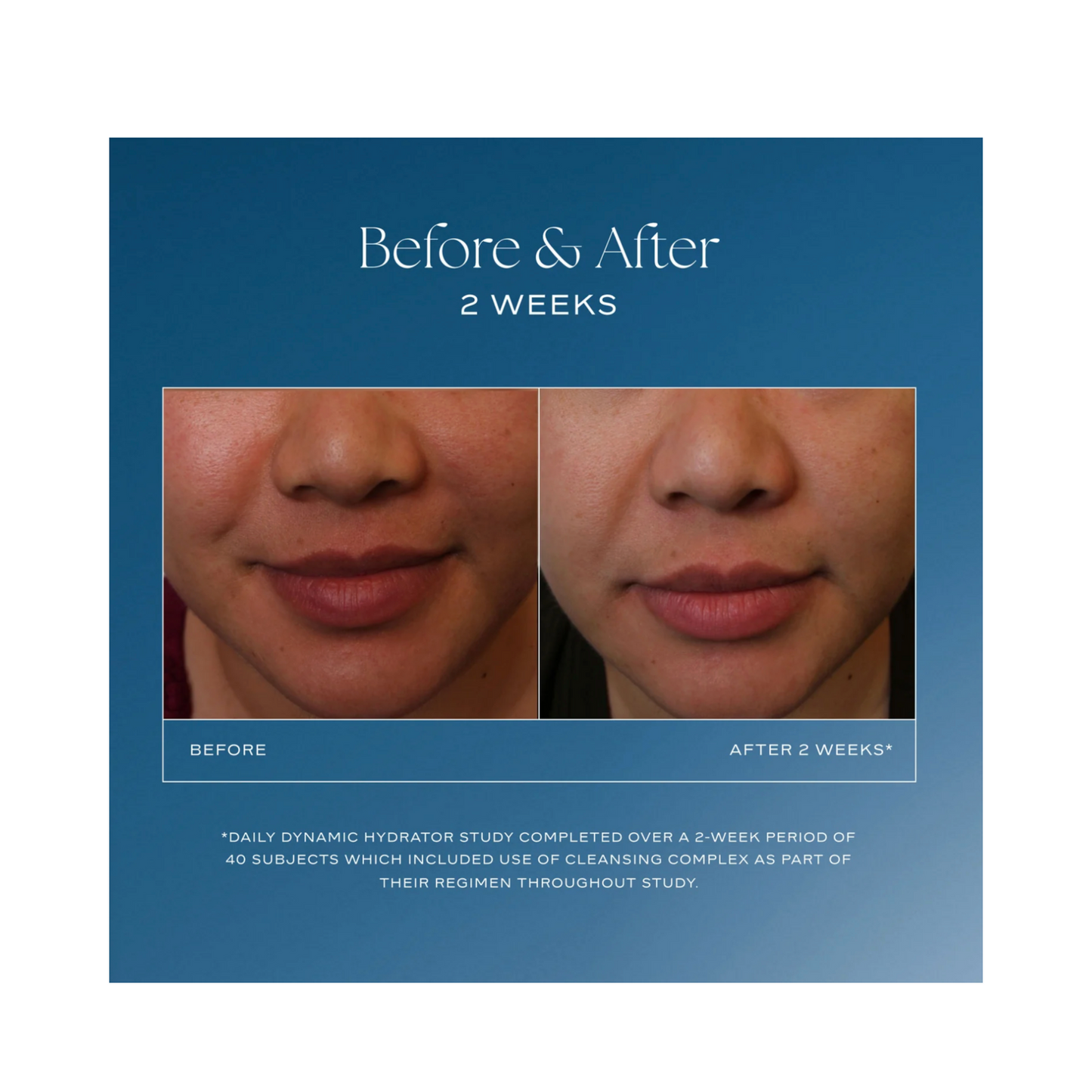 iS Clinical Daily Dynamic Hydrator