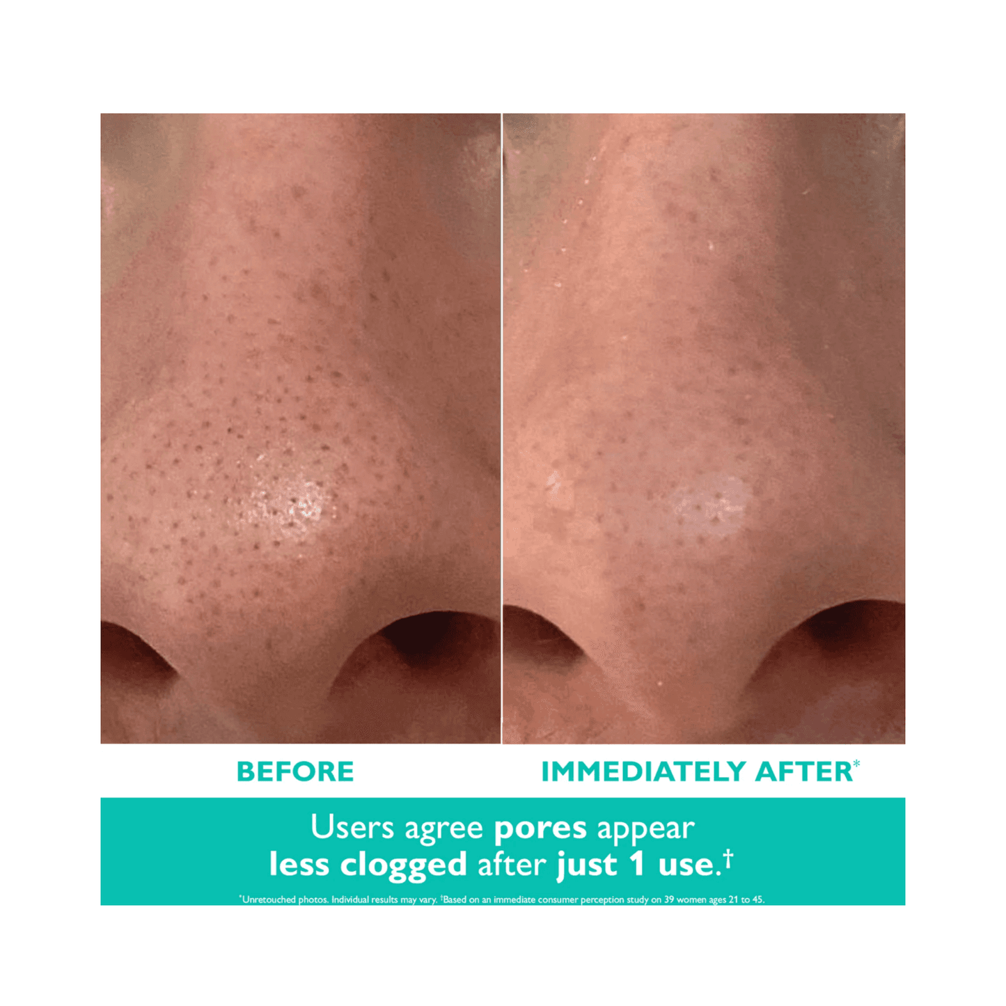 使用 Peter Thomas Roth 去角質霜進行毛孔護理前後的效果
