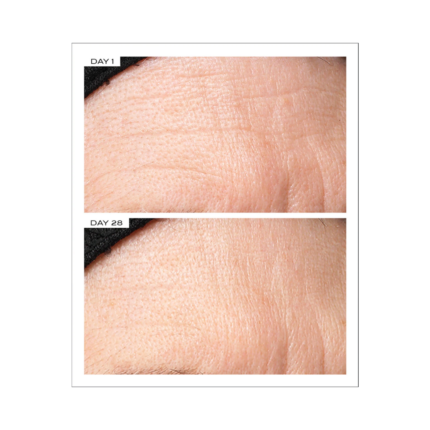 111SKIN Exosome Face Lift