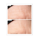 111SKIN Exosome Face Lift