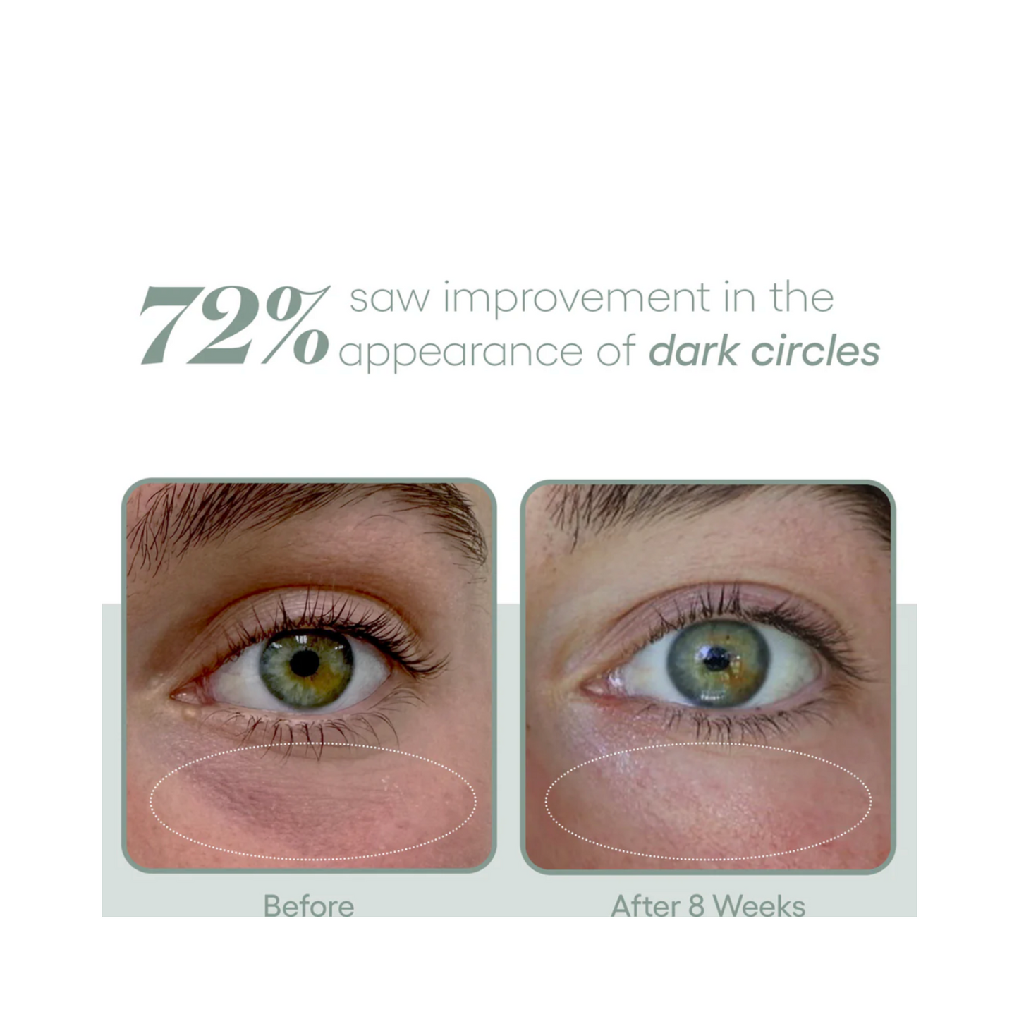 Soro ocular da ciência da pele banhada