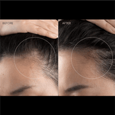 FOREO FAQ 301 LED Hair Strengthening Scalp Massager