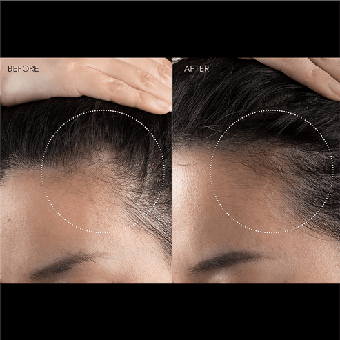 FOREO FAQ 301 LED Hair Strengthening Scalp Massager