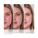 Before and after comparison of woman using jane iredale HydroPure Serum showing reduced redness and improved skin tone.