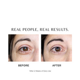 Cosmedix I-Complex Advanced Eye Gel