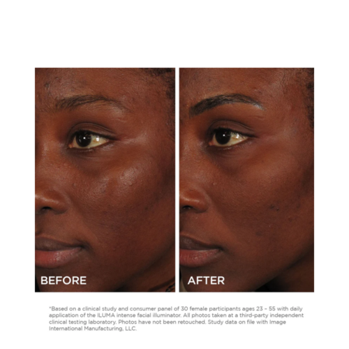 Imagen Skincare iluma Illuminador facial intenso