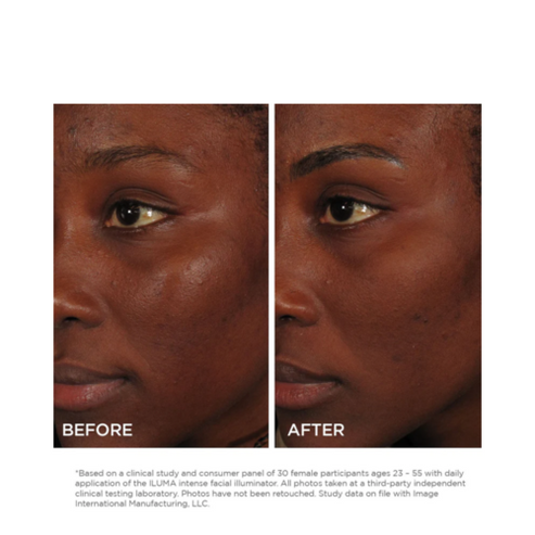 Imagen Skincare iluma Illuminador facial intenso