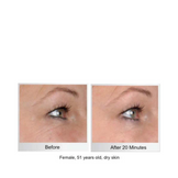 Circcell Insight Collagen Eye Treatment Masks