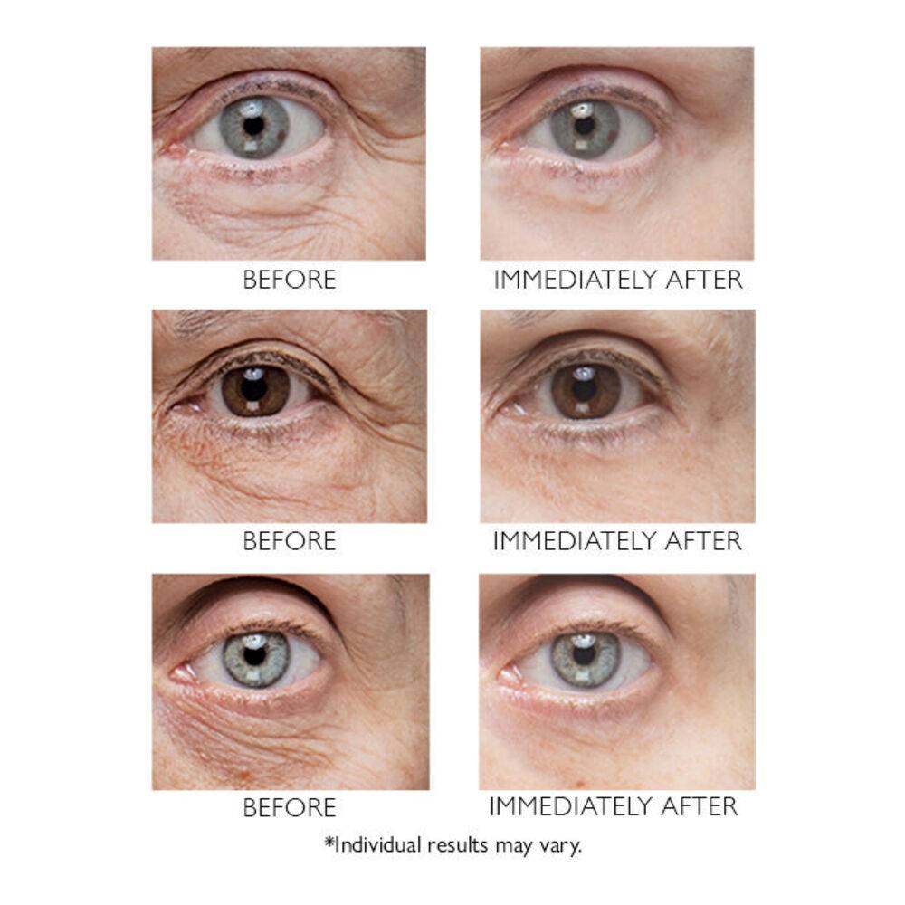 Peter Thomas Roth Instant FirmX Eye – eSkinStore