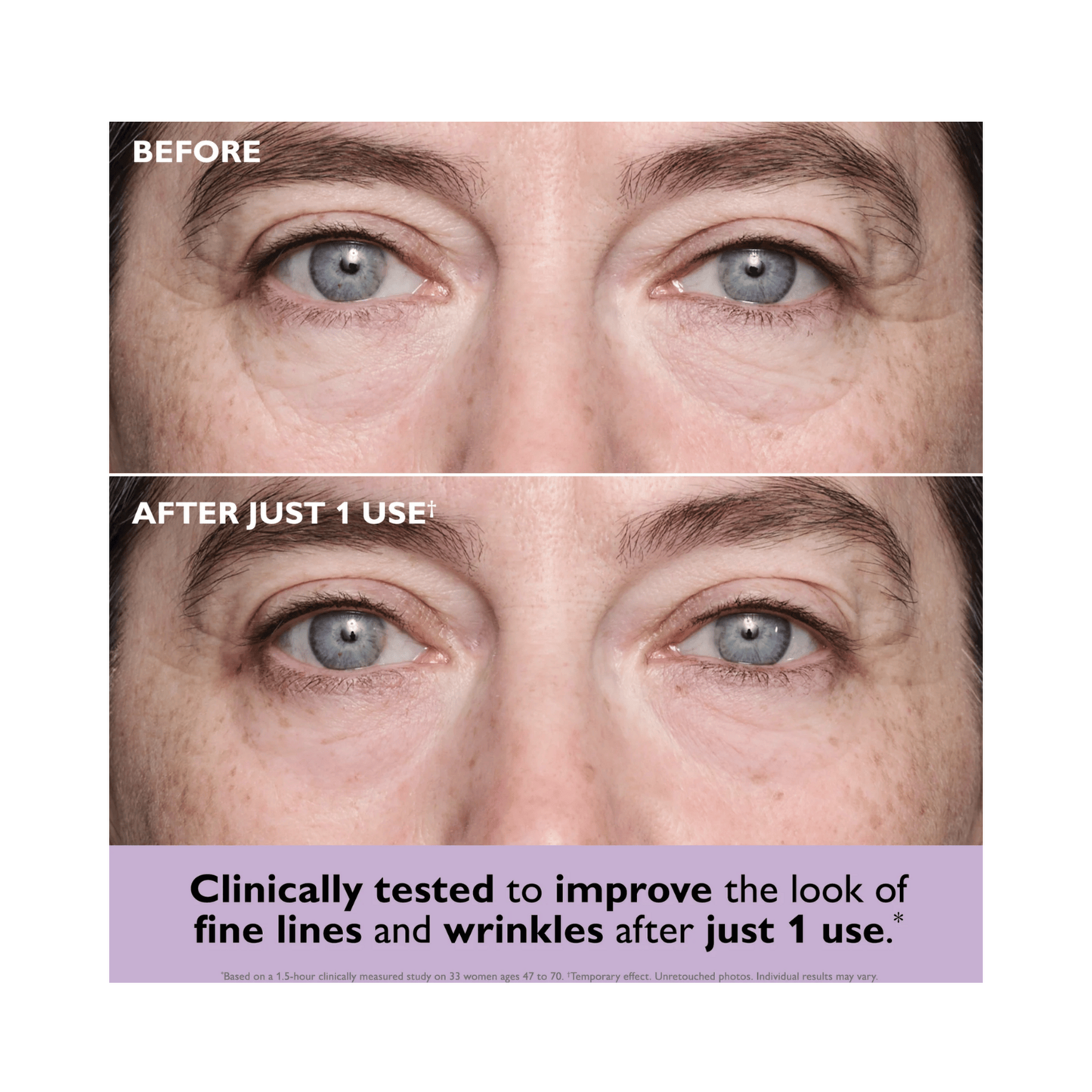 Peter Thomas Roth collagen eye patches for skin firming and anti-wrinkle