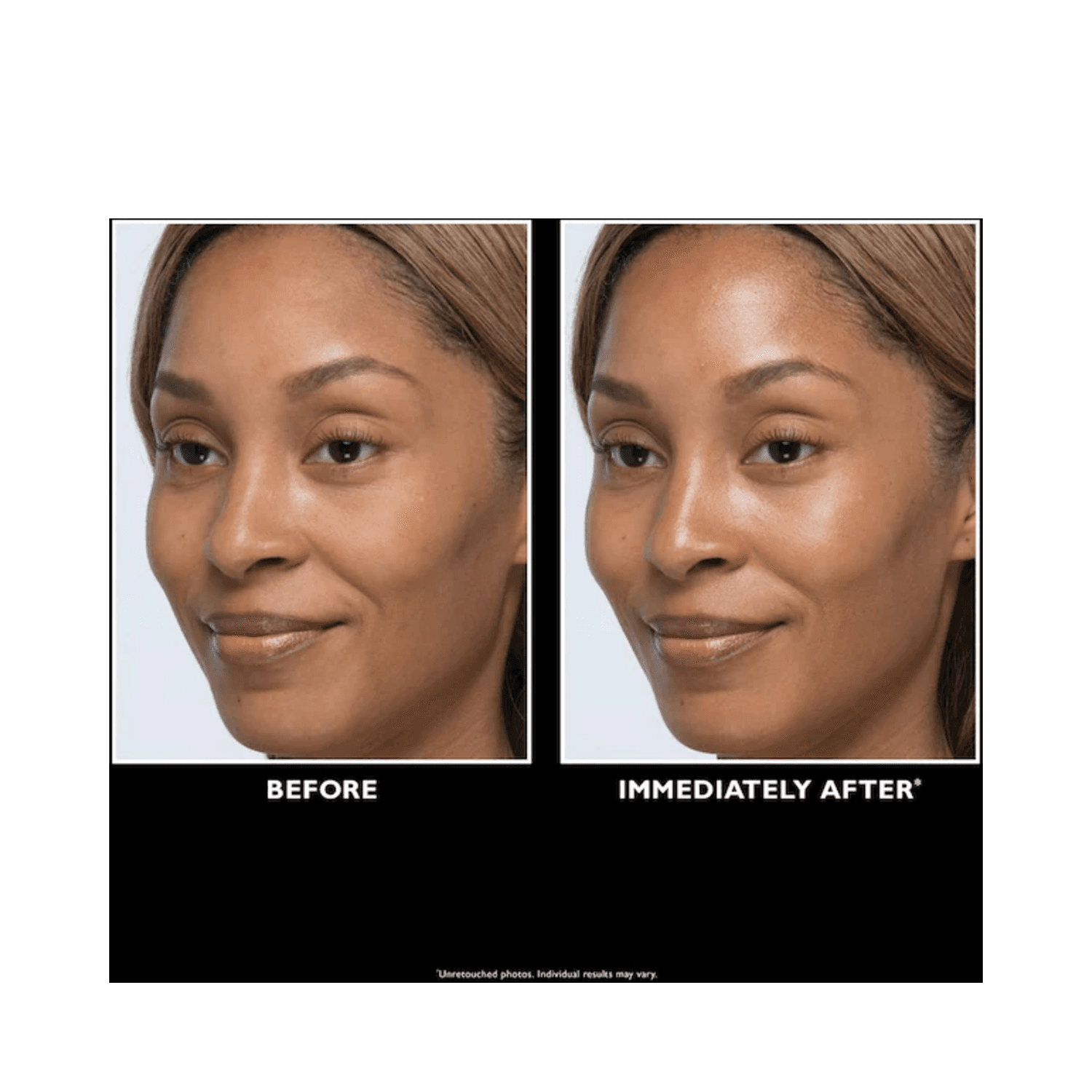 Before and after using Peter Thomas Roth Firmx Serum showing visible skin lift and glow. Ideal for dullness and loss of firmness.