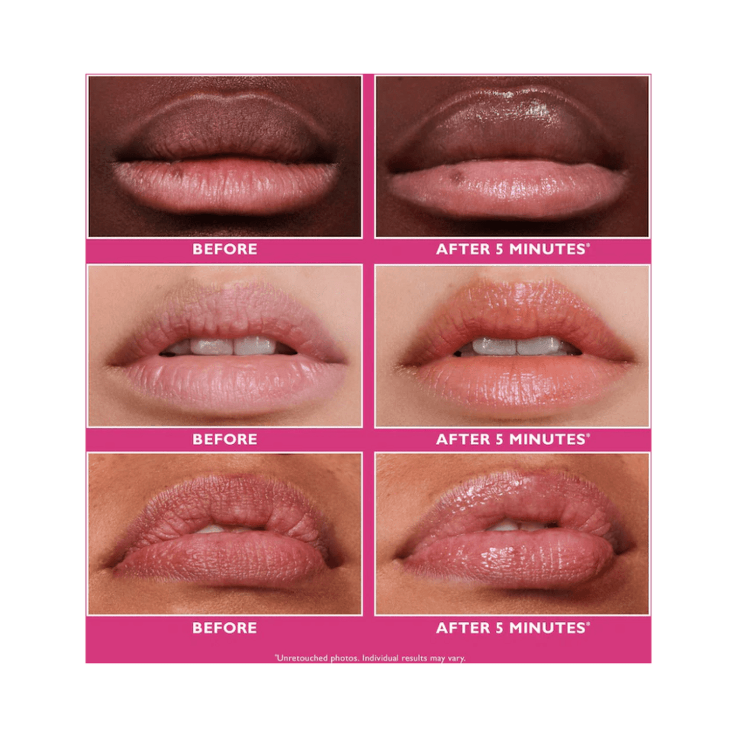 Comparison of lips before and after using Peter Thomas Roth Instant Firmx Lip Filler, showing enhanced fullness and smoothness in 5 minutes.