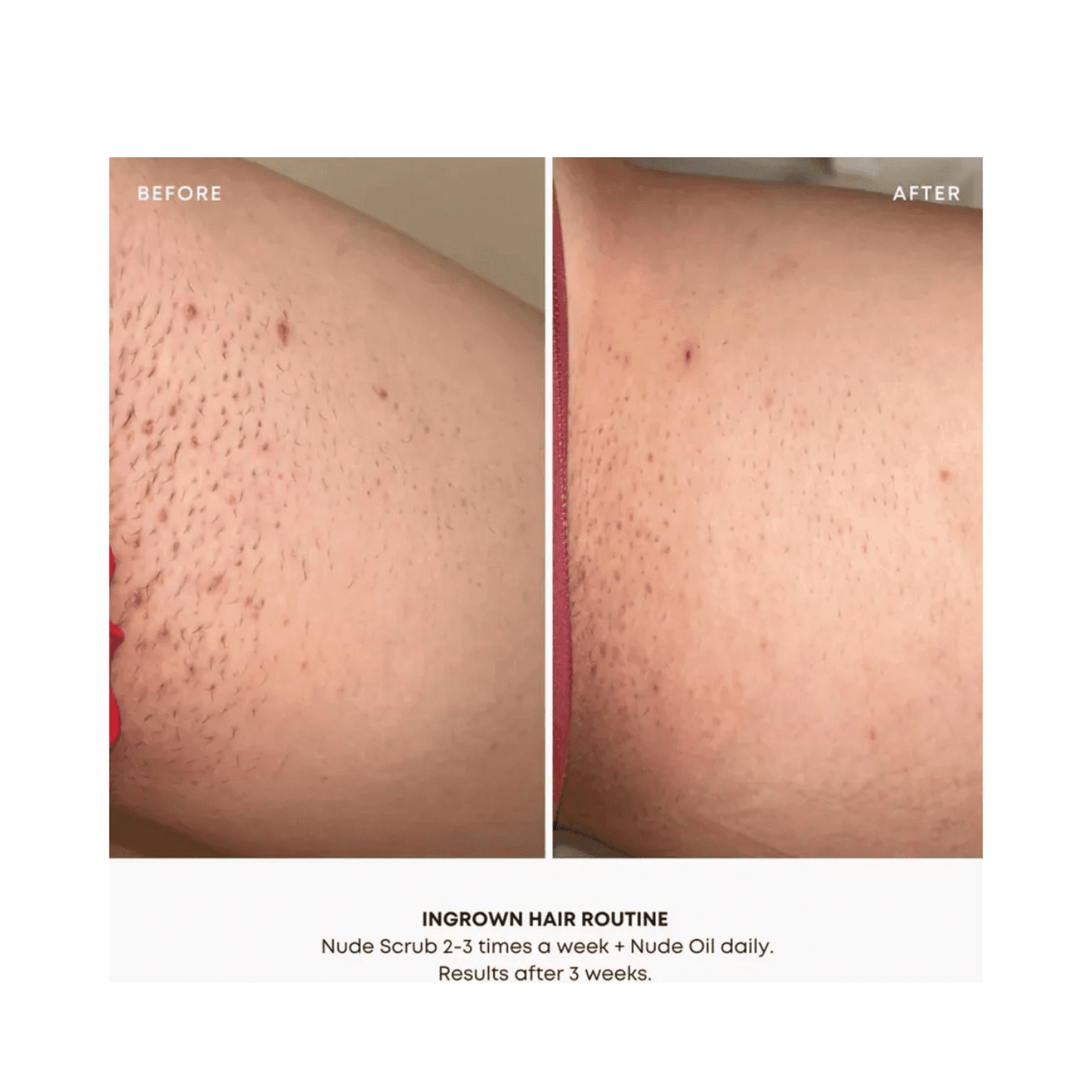 Bushbalm Nude Oil Ingrown Hair