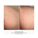 Bushbalm Nude Oil Ingrown Hair