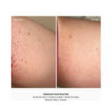 Bushbalm Nude Oil Ingrown Hair