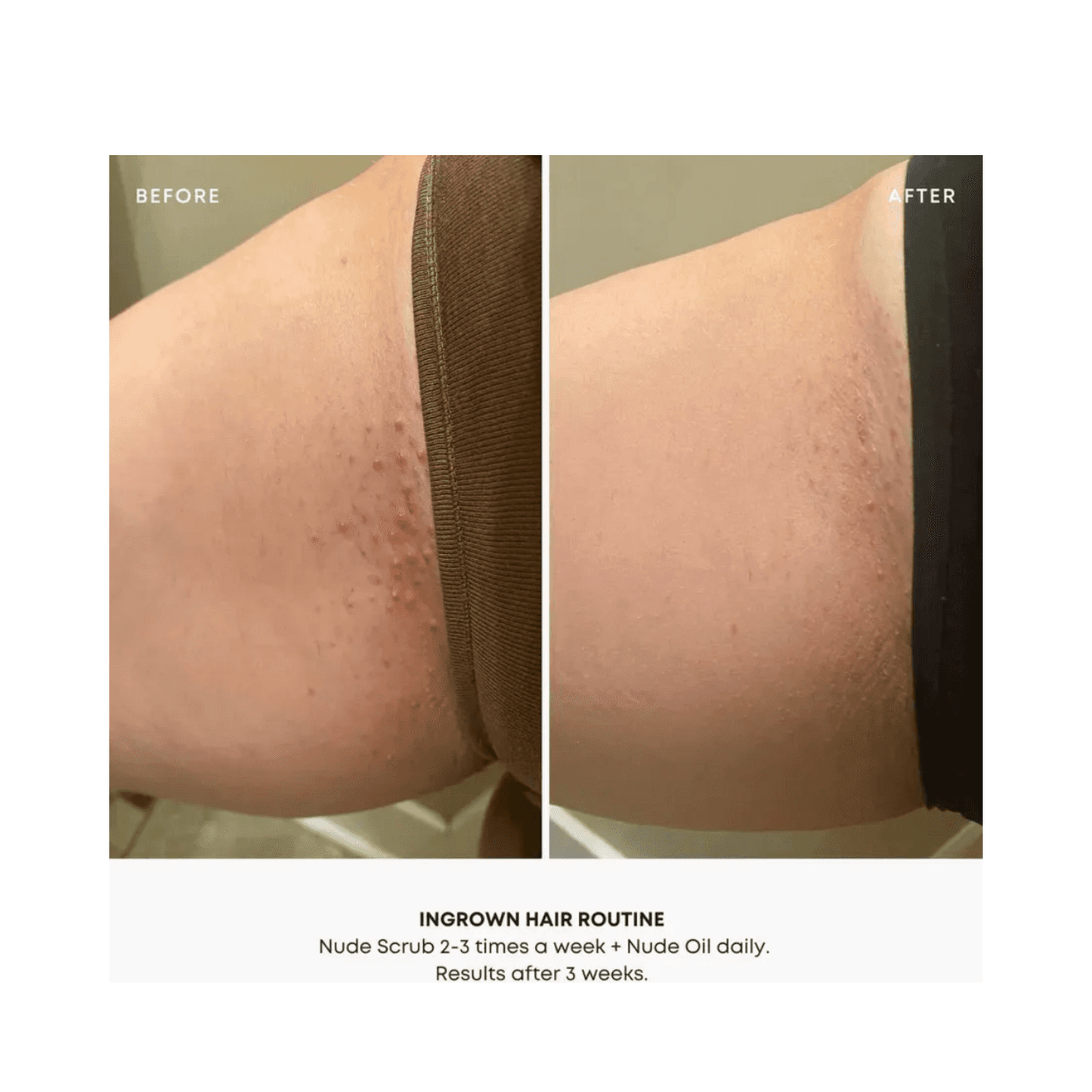 Bushbalm Nude Oil Ingrown Hair