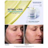 Obagi RETINOL + PHA Refining Night Cream